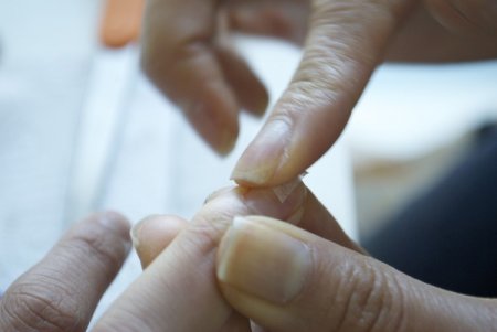 Что делать со сломанным ногтем