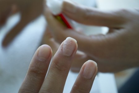 Что делать со сломанным ногтем